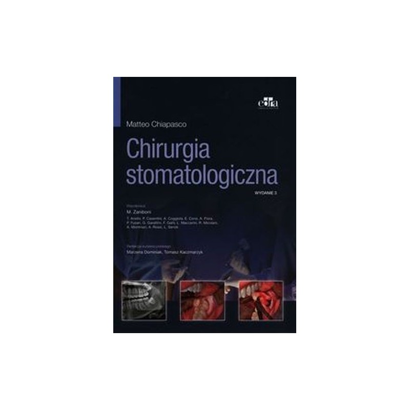 CHIRURGIA STOMATOLOGICZNA