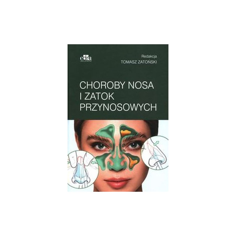 CHOROBY NOSA I ZATOK PRZYNOSOWYCH