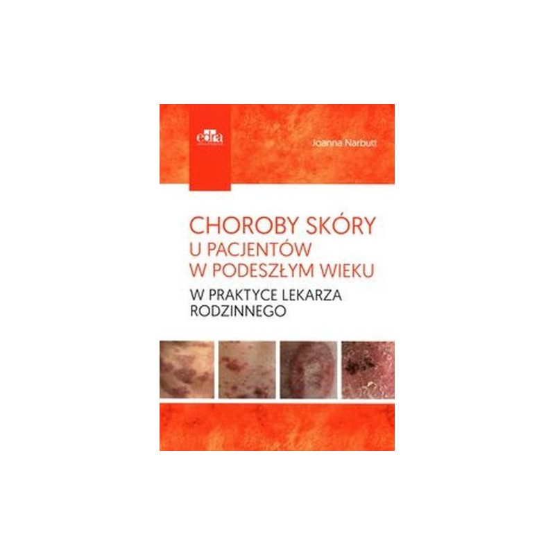 CHOROBY SKÓRY U PACJENTÓW W PODESZŁYM WIEKU W PRAKTYCE LEKARZA RODZINNEGO