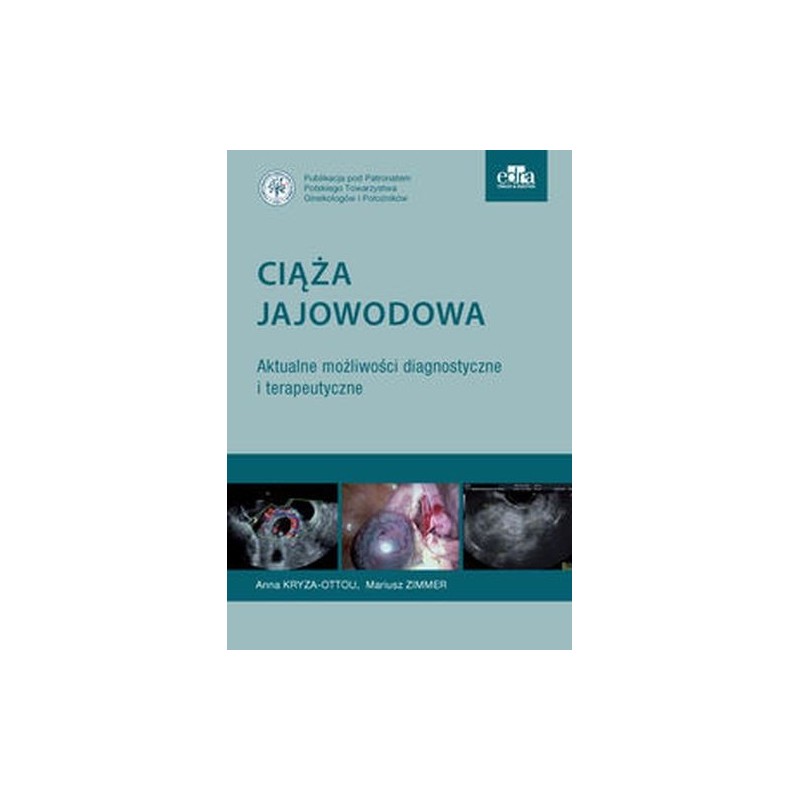 CIĄŻA JAJOWODOWA AKTUALNE MOŻLIWOŚCI DIAGNOSTYCZNE I TERAPEUTYCZNE