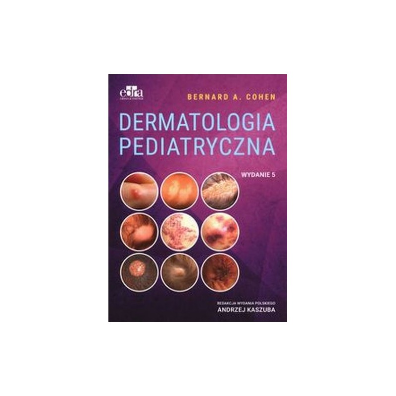 DERMATOLOGIA PEDIATRYCZNA