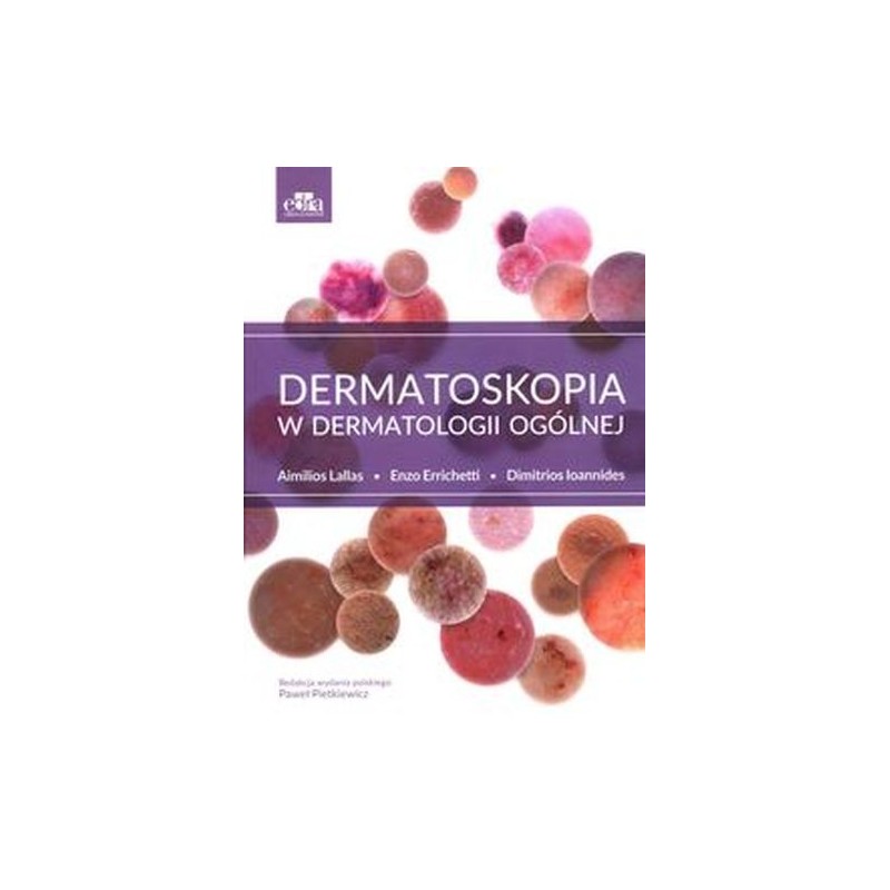 DERMATOSKOPIA W DERMATOLOGII OGÓLNEJ