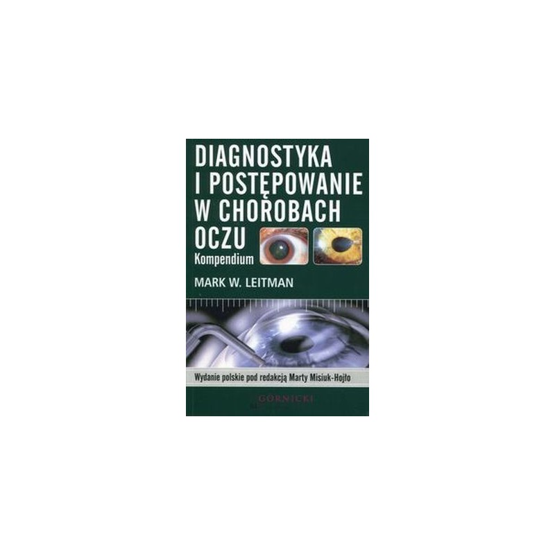 DIAGNOSTYKA I POSTĘPOWANIE W CHOROBACH OCZU