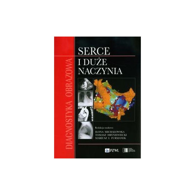 DIAGNOSTYKA OBRAZOWA SERCE I DUŻE NACZYNIA