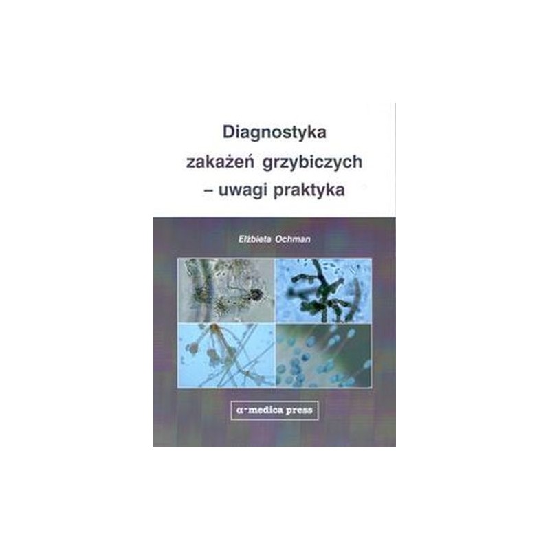 DIAGNOSTYKA ZAKAŻEŃ GRZYBICZYCH - UWAGI PRAKTYKA