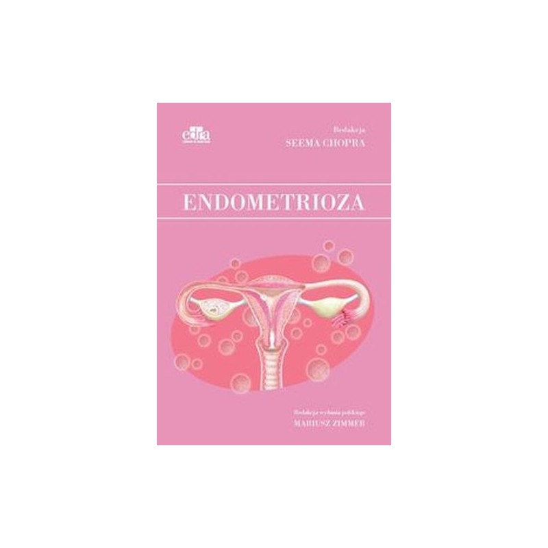 ENDOMETRIOZA