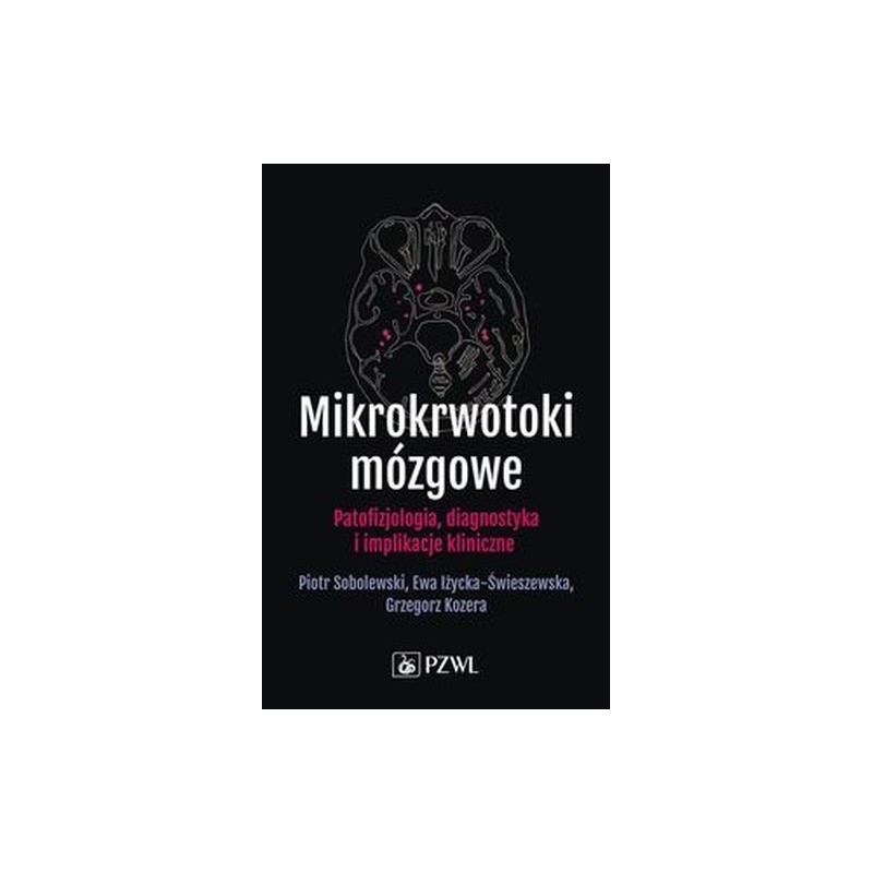 MIKROKRWOTOKI MÓZGOWE