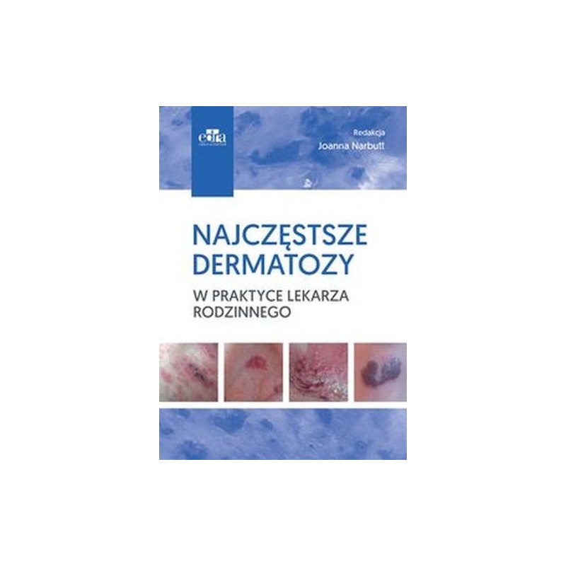 NAJCZĘSTSZE DERMATOZY W PRAKTYCE LEKARZA RODZINNEGO