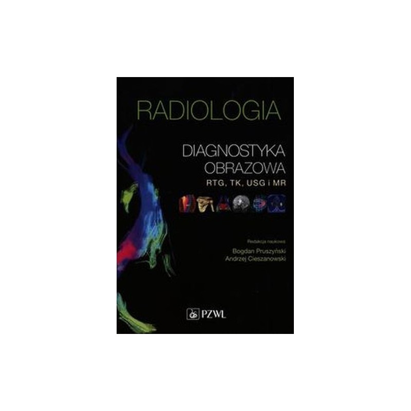 RADIOLOGIA DIAGNOSTYKA OBRAZOWA RTG TK USG I MR