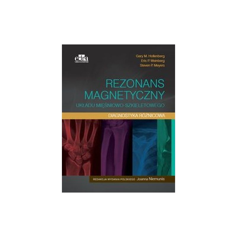 REZONANS MAGNETYCZNY UKŁADU MIĘŚNIOWO-SZKIELETOWEGO DIAGNOSTYKA RÓŻNICOWA