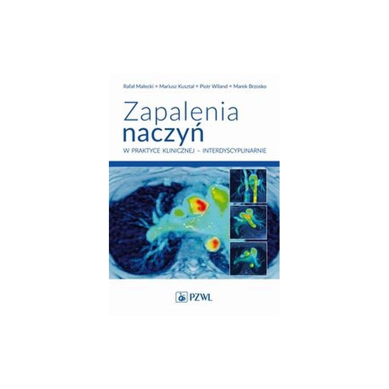 ZAPALENIA NACZYŃ W PRAKTYCE KLINICZNEJ INTERDYSCYPLINARNIE