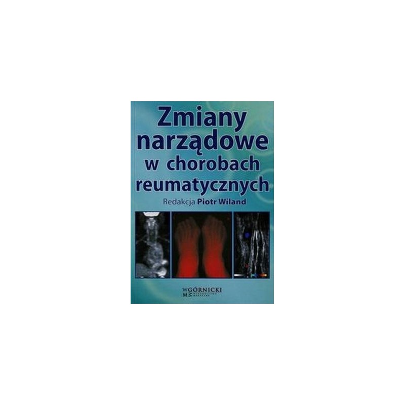 ZMIANY NARZĄDOWE W CHOROBACH REUMATYCZNYCH