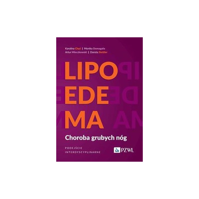 LIPOEDEMA