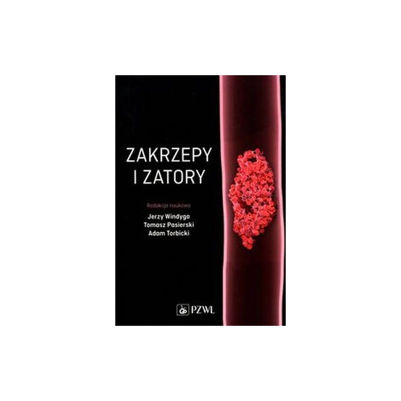 ZAKRZEPY I ZATORY