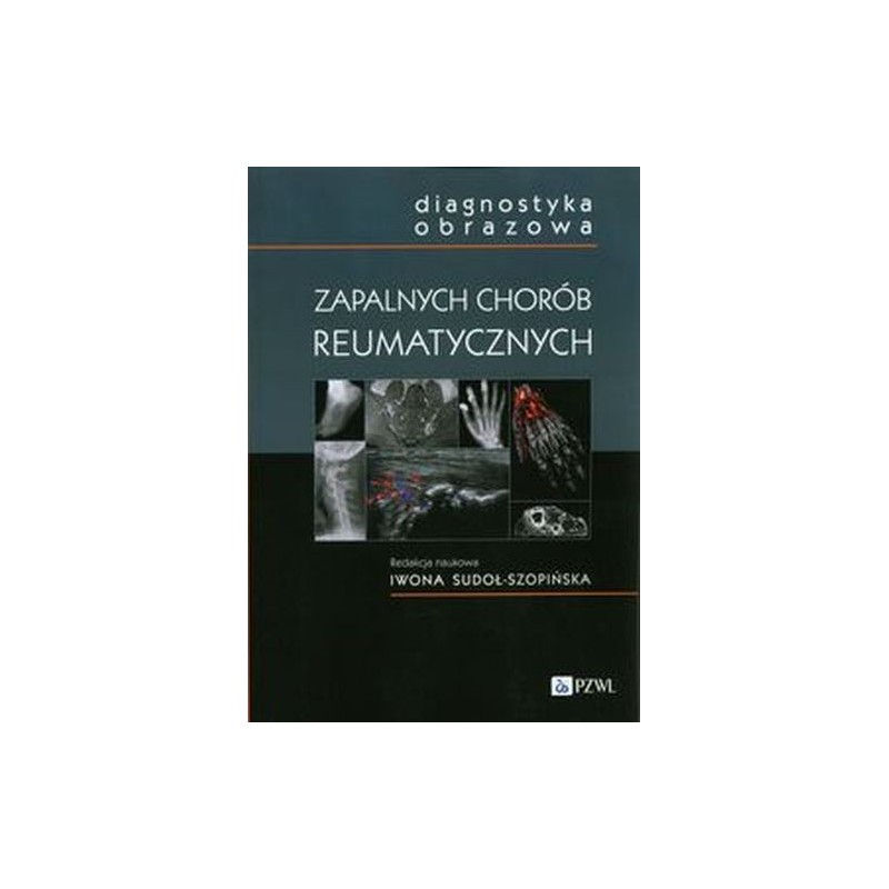 DIAGNOSTYKA OBRAZOWA ZAPALNYCH CHORÓB REUMATYCZNYCH