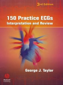 150 PRACTICE ECGS - J. Taylor George