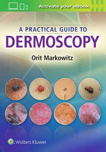 A PRACTICAL GUIDE TO DERMOSCOPY - Markowitz Orit