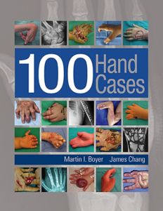 100 HAND CASES - I. Boyer Martin
