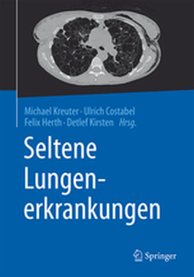 SELTENE LUNGENERKRANKUNGEN - Michael Costabel Ulr Kreuter