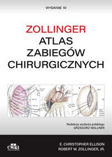 ATLAS ZABIEGÓW CHIRURGICZNYCH. ZOLLINGER -  Zollinger